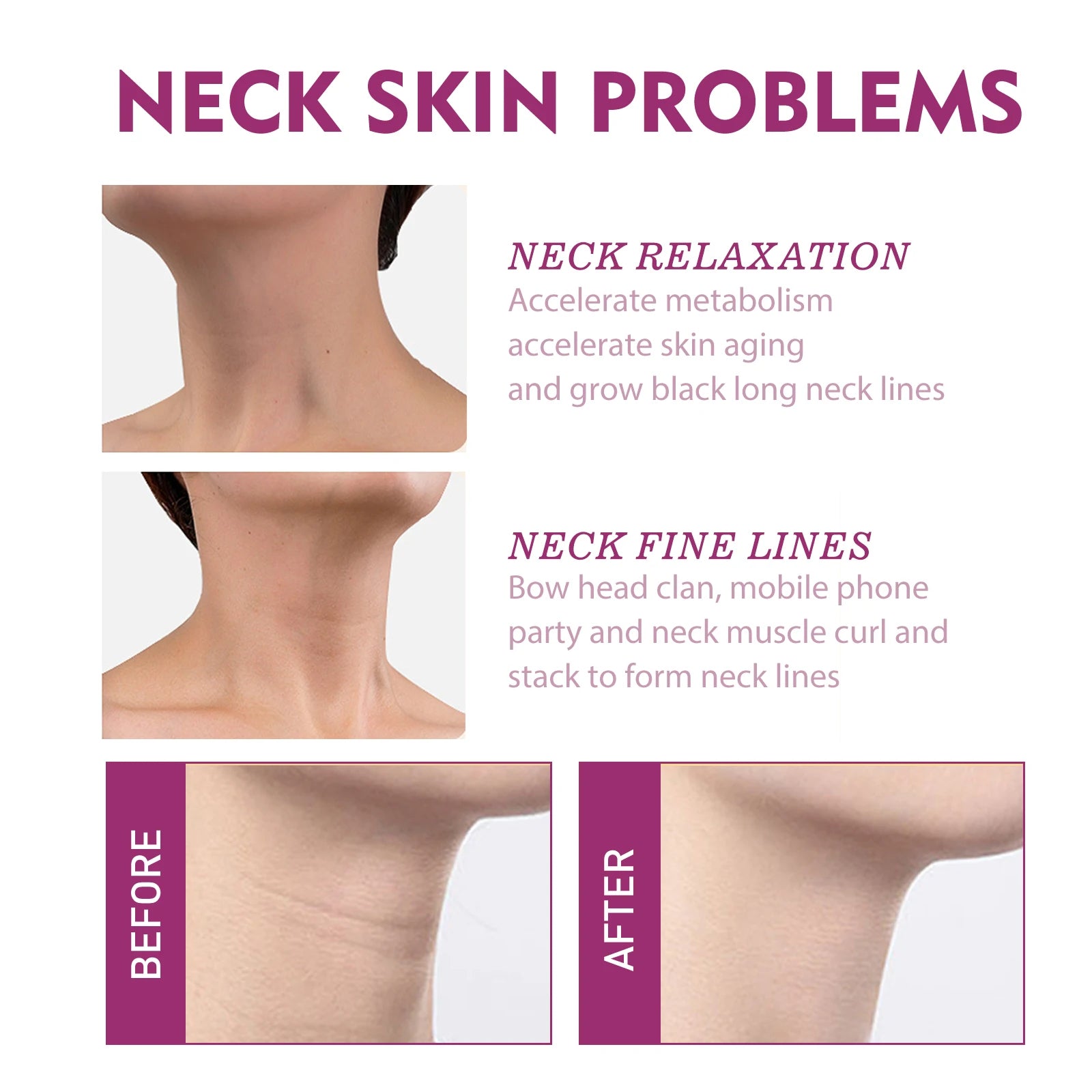 Hydrolyzed Collagen Neck Cream Firming Delaying Aging Increase Skin Elasticity Reduce Fine Lines Moisturizing Neck Care Lotion Oasis Select