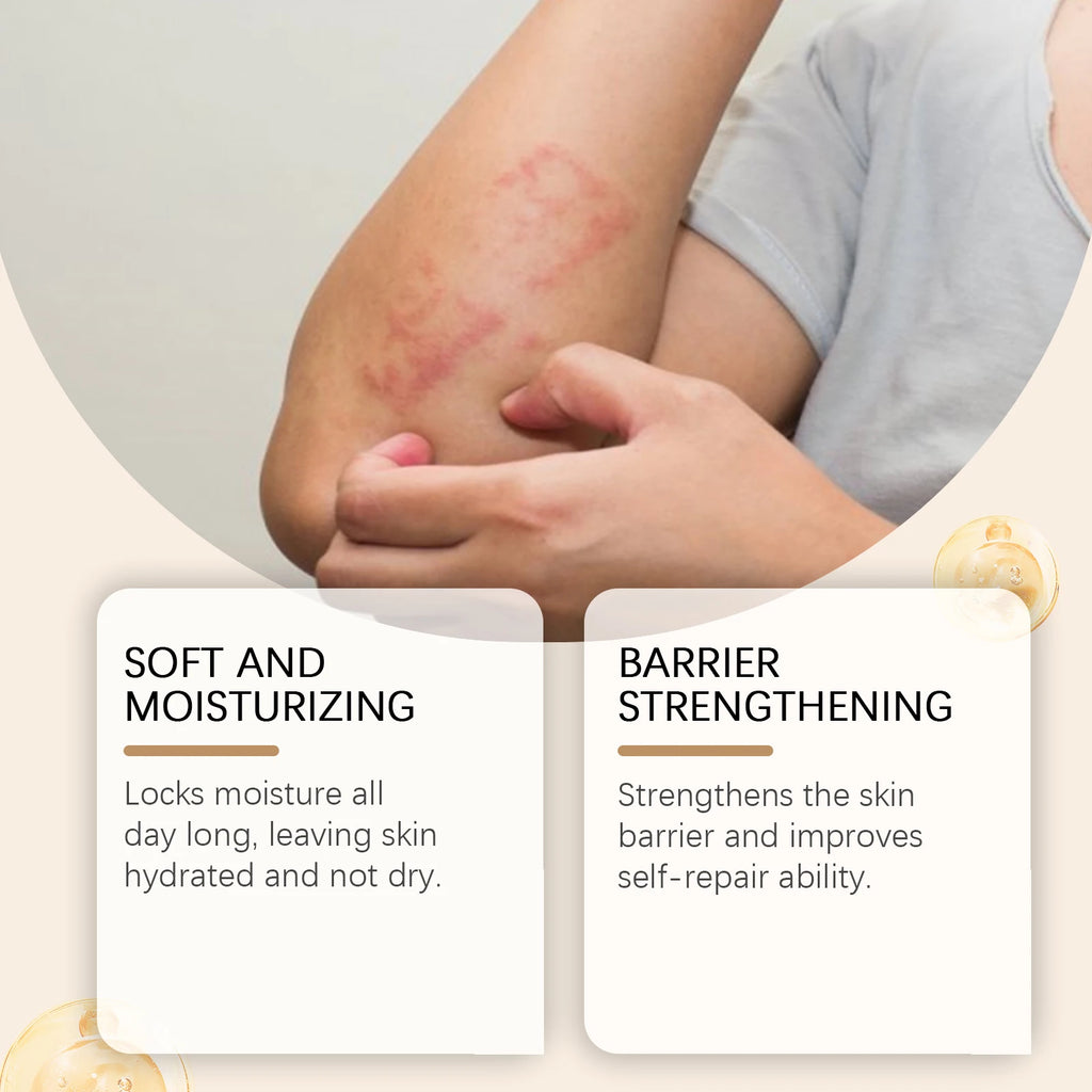 Ximonth Skin Care Cream Skin Moisturizing Treatment Dermatitis Psoriasis Relieve Allergies Fungal Infection Skin Care Product Oasis Select