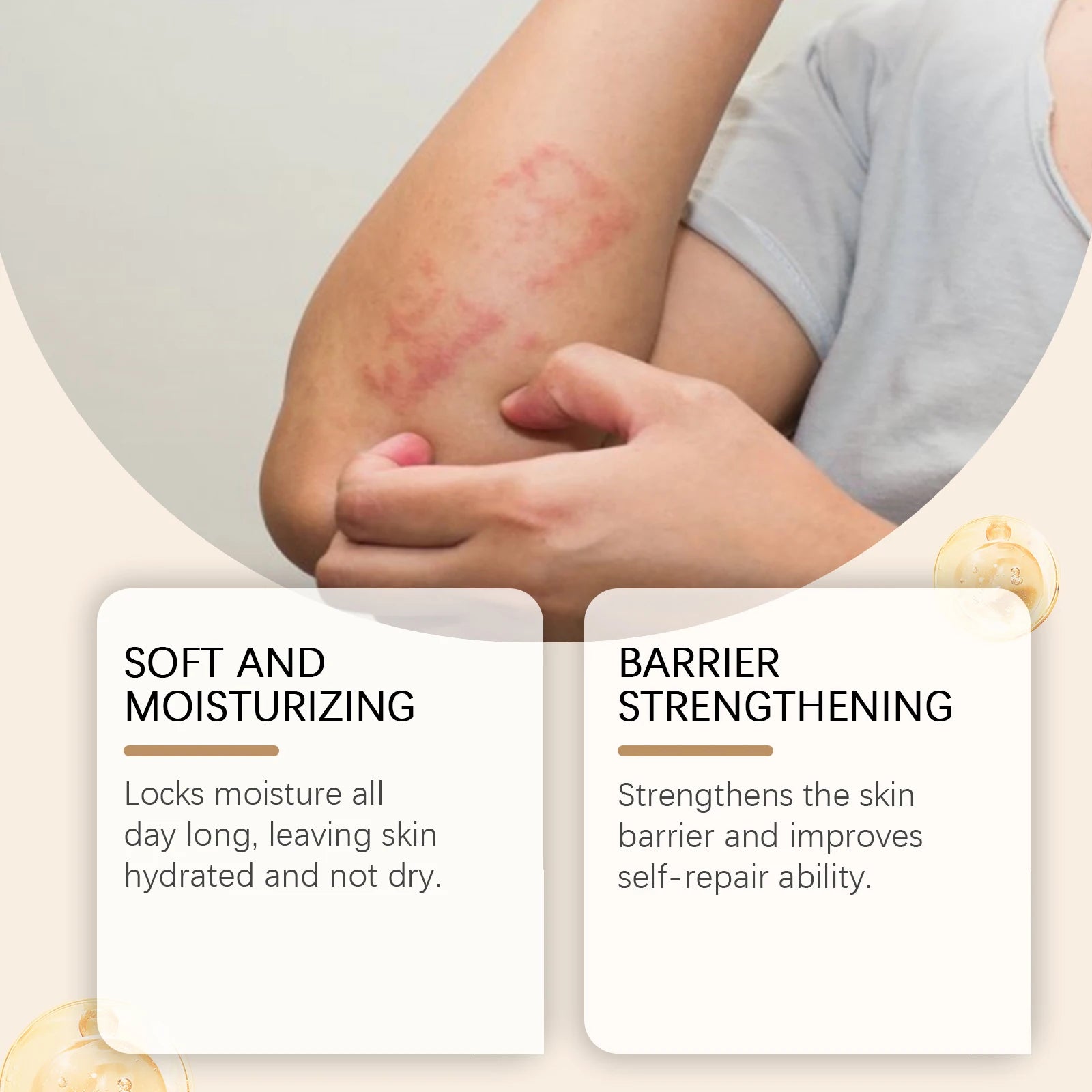 Ximonth Skin Care Cream Skin Moisturizing Treatment Dermatitis Psoriasis Relieve Allergies Fungal Infection Skin Care Product Oasis Select