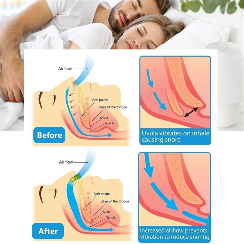 Silicone Magnetic Nose Clip – Anti-Snoring Sleep Aid with Case Anti-Snoring Nose Clip Oasis Select