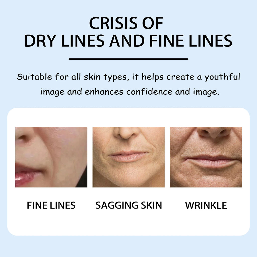 Moisturizing Nasolabial Folds Patch Lifting Firming Fade Fine Lines Facial Skin Moisturizing Hydrating Smile Lines Gel Patches Oasis Select