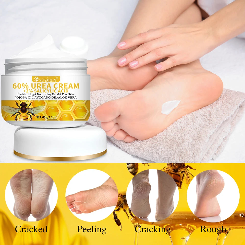 60% Urea & 2% Salicylic Acid Foot Cream for Cracked Heels - Exfoliating, Moisturizing, Hard Skin, Callus & Dead Skin Remover. Oasis Select