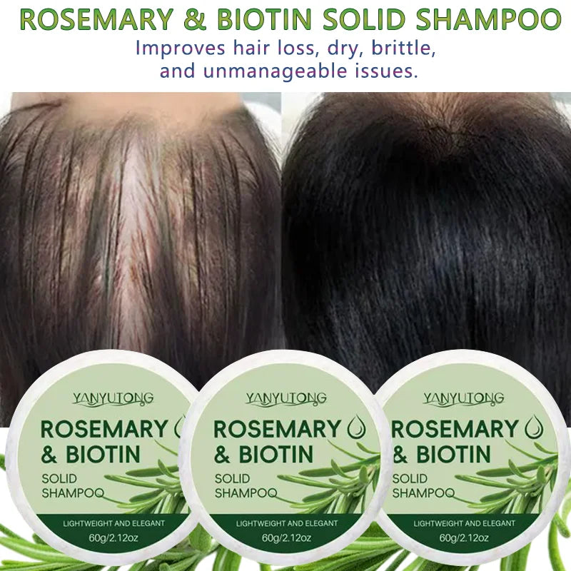 Rosemary Shampoo Soap: Deep Cleansing, Moisturizing and Nourishing, Scalp Relief and Oil Control, Hair Growth and Care, Daily Sh Oasis Select 3PCS