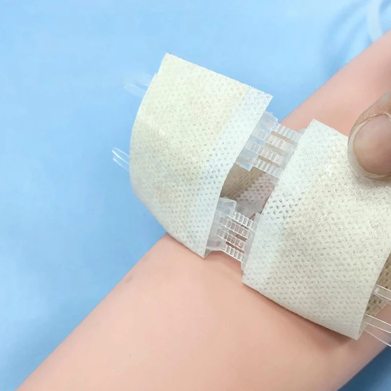 Zipper Wound Closure Strips | No-Suture Fast Closure Patch
