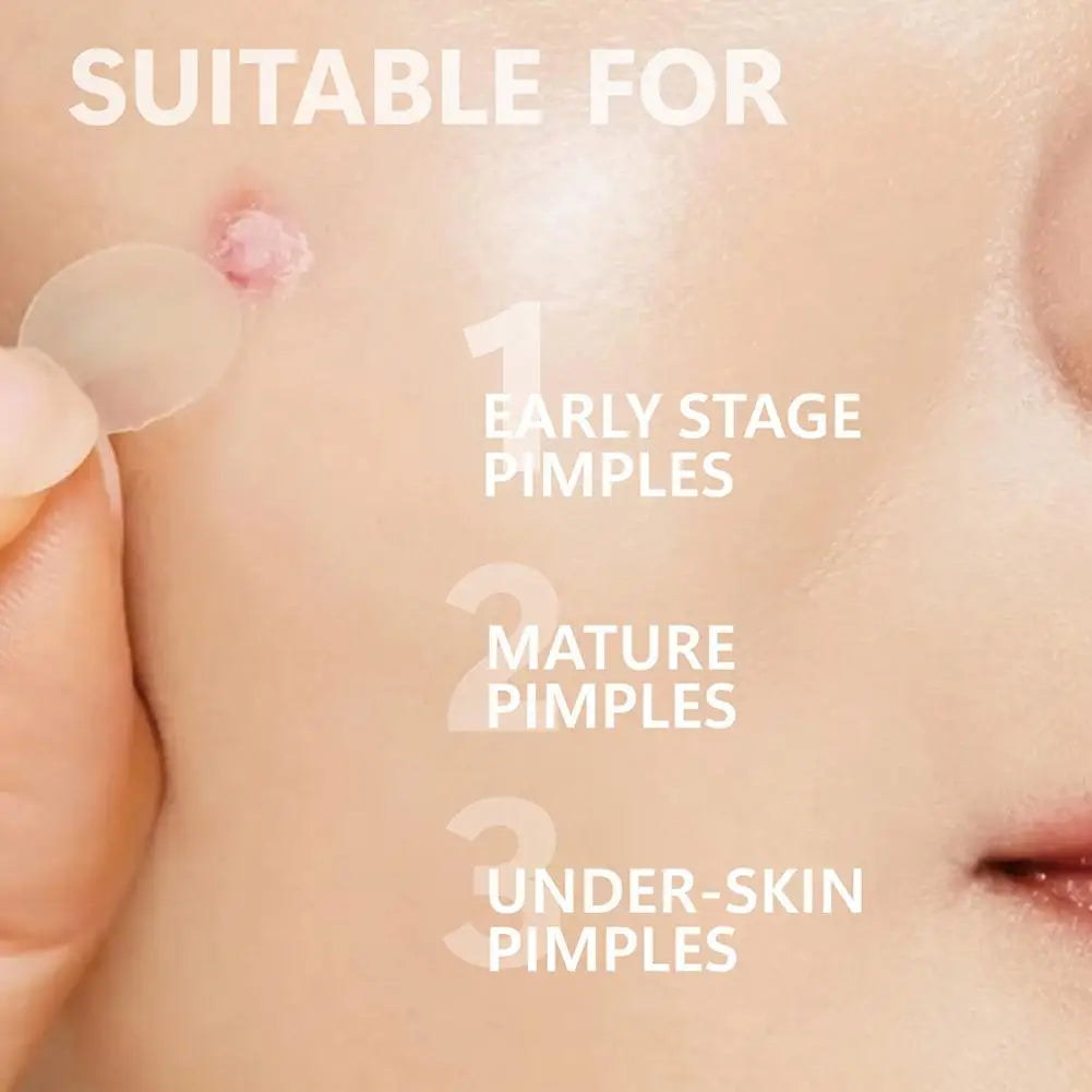 12/24pcs Acne Microneedle Patches For Overnight Use,Hydrocolloid Technology Dissolves Blemishes, Invisible Skin Care 0.2mm Oasis Select