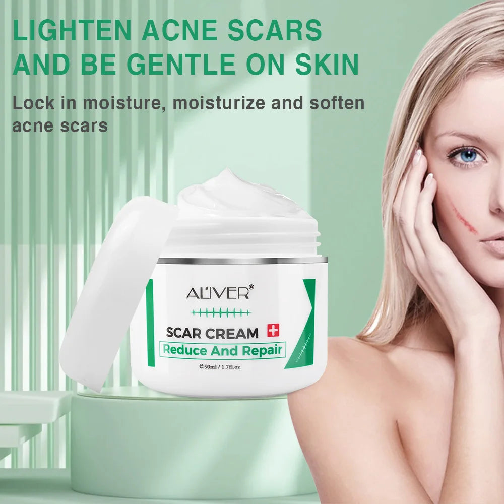 ALVER Acne Scar Stretch Marks Remover Cream Skin Repair Acne Black Dots Spots Acne Treatment Blackhead Bleaching Cream 50ml Oasis Select
