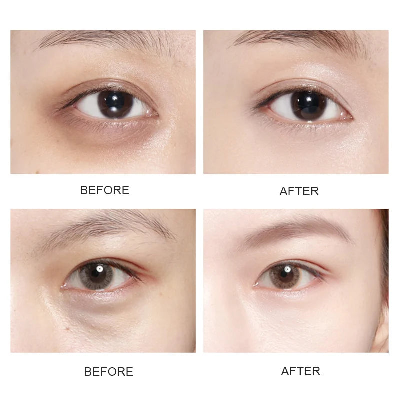 BIOAOUA Crystal Gold Collagen Eye Patches – Dark Circles Collagen Eye Mask Oasis Select