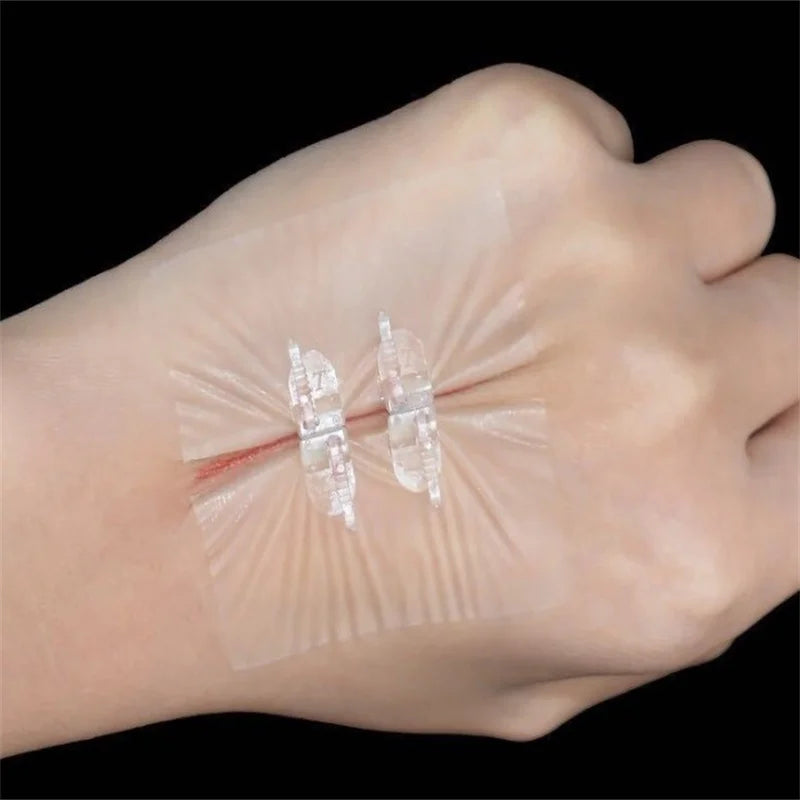 Emergency Wound Closure Zip Stitch Sutures Bandaids Repair Wounds Without Stitches For Outdoor Activities Quick Clot Wound Oasis Select