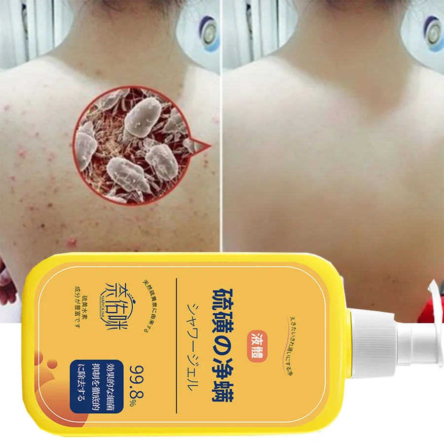 400ml Sulfur Shower Gel – Oil Control & Pore Cleansing Wash
