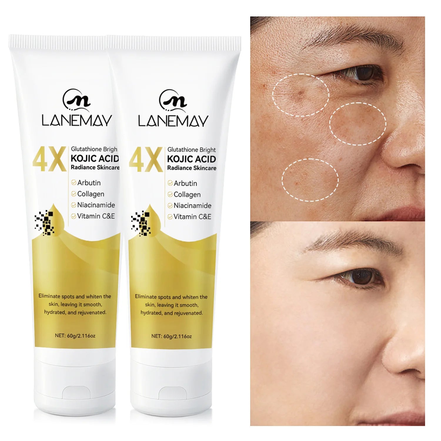 2-Pack Glutathione & Kojic Acid Brightening Cream 60g Brightening Face Cream Oasis Select