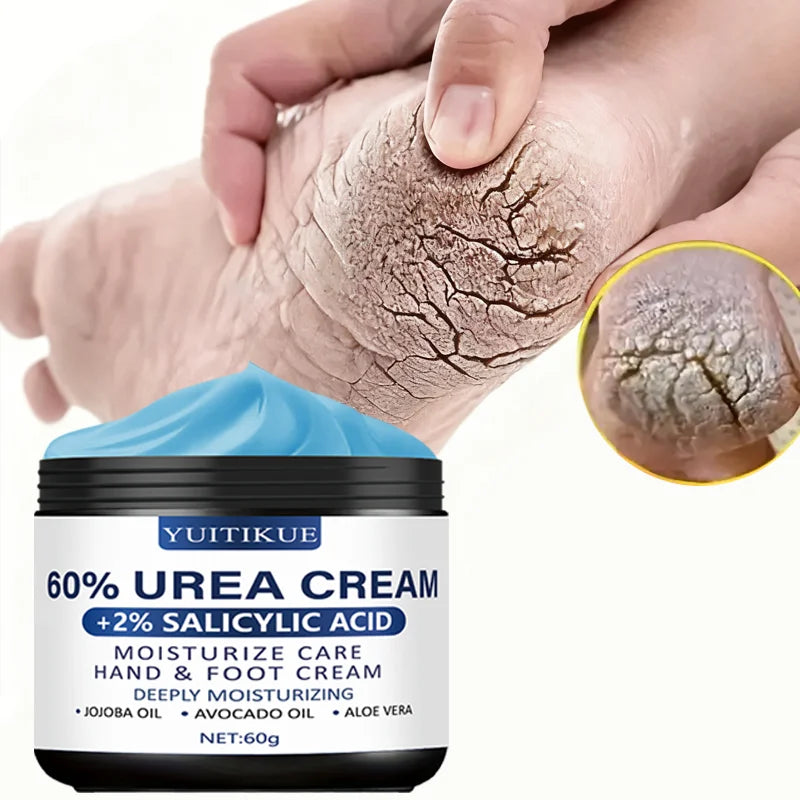 YUITIKUE 60% Urea Foot Cream – Dry Heel Repair 60g
