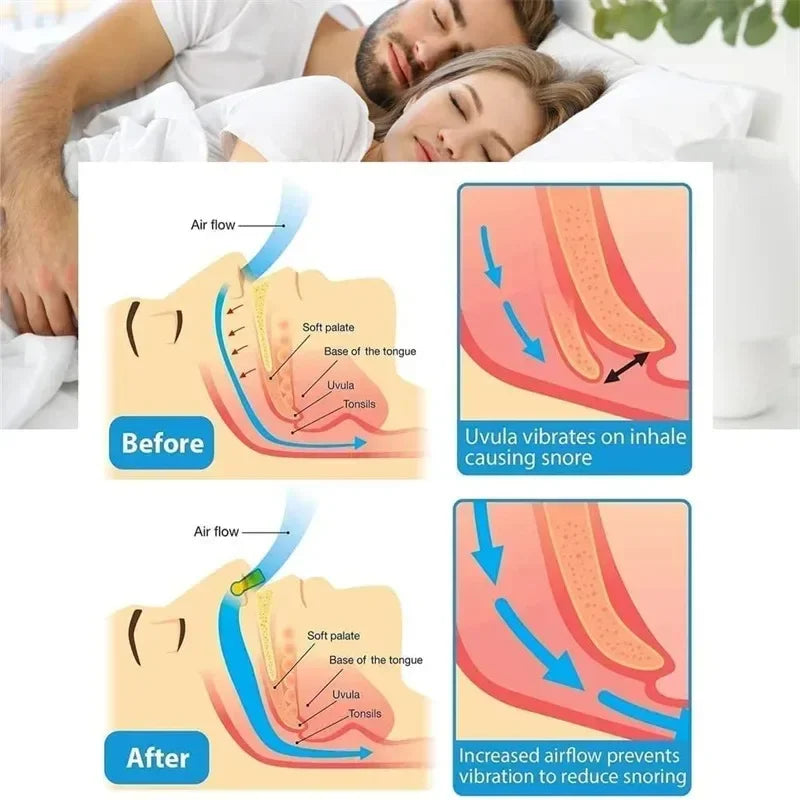 Silicone Magnetic Anti Snore Stop Snoring Nose Clip Sleep Tray Sleeping Aid Apnea Guard Night Device with Case Anti Ronco Oasis Select