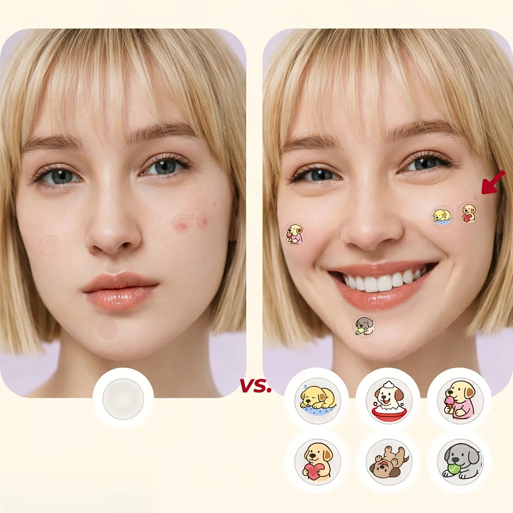 144/192pcs Acne Patch - Cute puppy shaped design, suitable for various light skin tones, daily use&photo props, facial acne patc Oasis Select