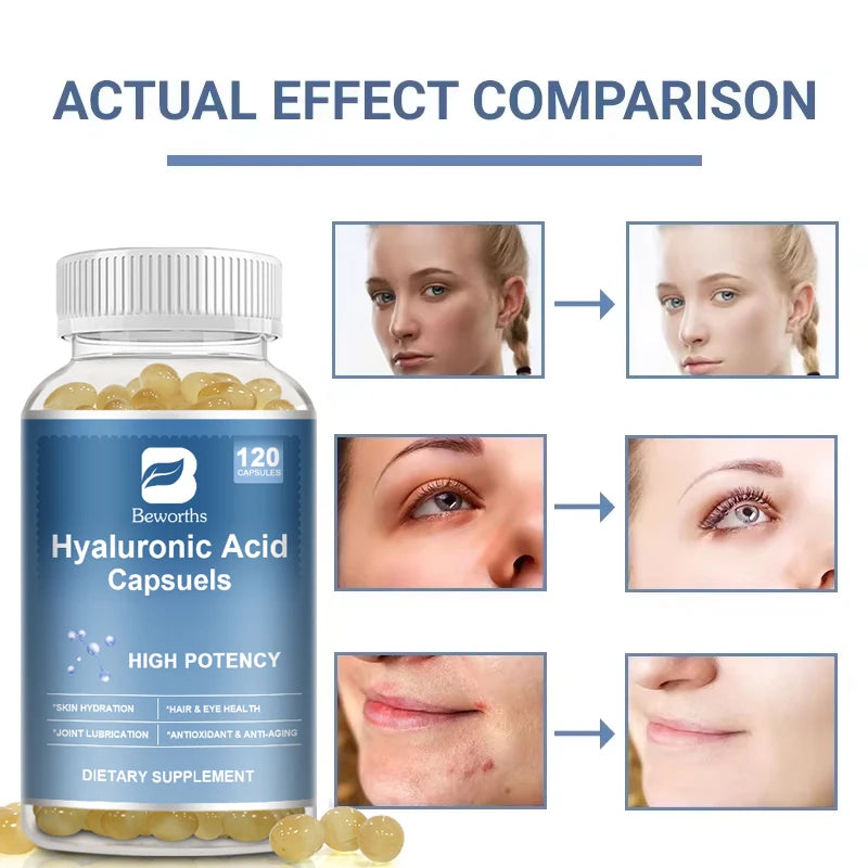 BEWORTHS Hyaluronic Acid Capsules Support Skin &Joint Health Antioxidant Whitening, Spot Reduction and Enhance Joint Flexibility Oasis Select