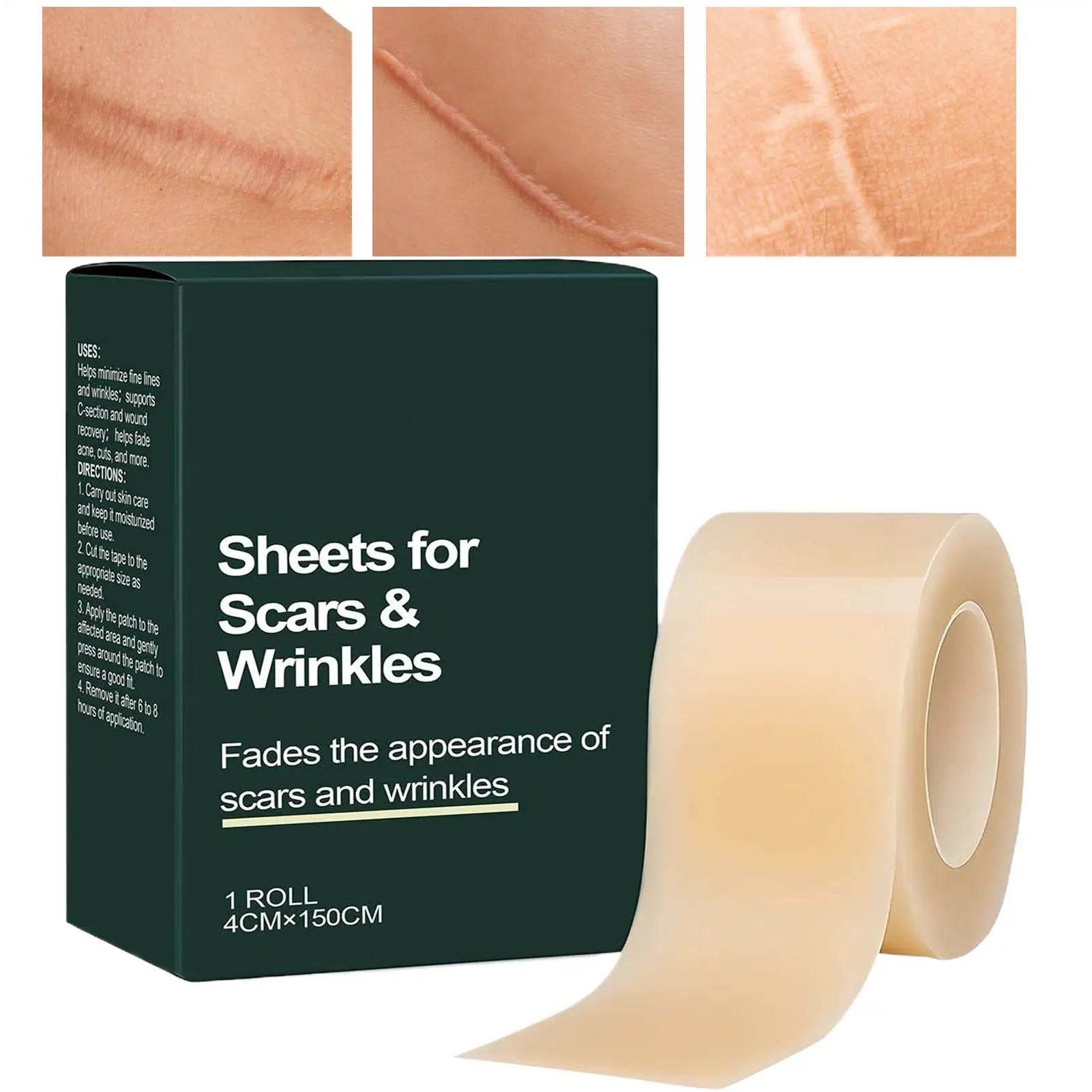 4cmx150cm 1Roll Silicone Scar Sheet Painless Scar Repair Tape Removal Strip For Surgery Burn Acne Roll Effective Scar Oasis Select
