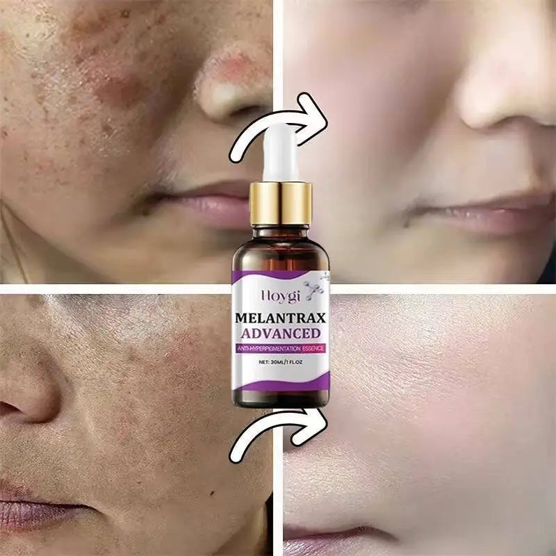 Hoygi Niacinamide Facial Serum Vitamin B3 Wrinkles Pigment Dark Spot Removal Correcting Glow Serum Face Whitening Moisturizer Oasis Select