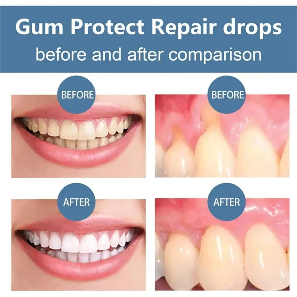 Eelhoe Gum Repair Gel Toothpaste – Tartar, Enamel & Gum Care