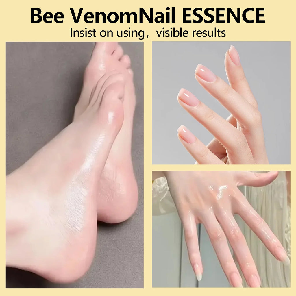 7X Fast Bee Venom Nail Essence – Nail Care, All Skin Types Nail Care Essence Oasis Select
