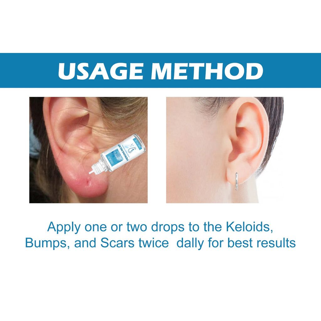 Eelhoe 30ml Ear Piercing Aftercare Solution – Allergy Safe