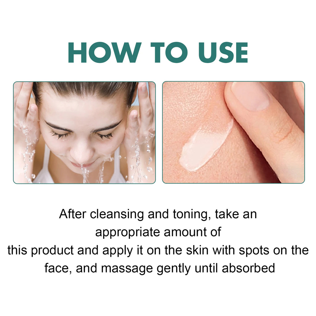EELHOE Niacinamide Freckle & Melasma Removal Cream 30g