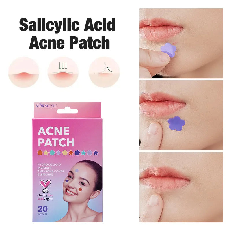 Colorful Star Acne Patches – Pimple & Blackhead Treatment 20pc Acne Patch Treatment Oasis Select