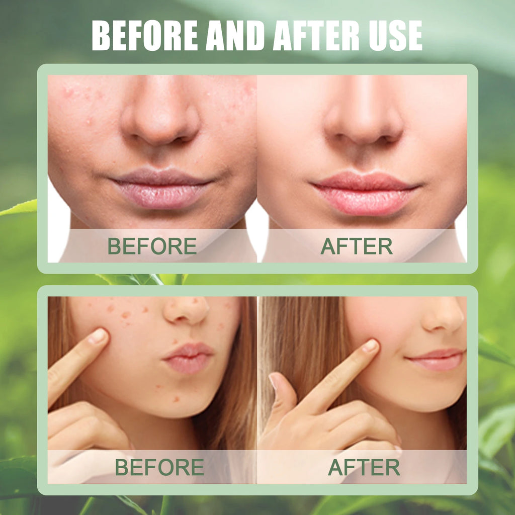 Green Tea Solid Mask Stick – Deep Cleanse & Pore Refining