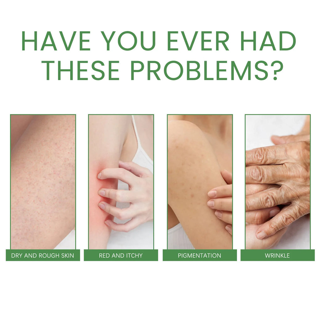Collagen Body Moisturizing Cream Improve Lighten Remove Darken Reduce Pigmentation Soothing Repair Private Parts Brighten Lotion Oasis Select