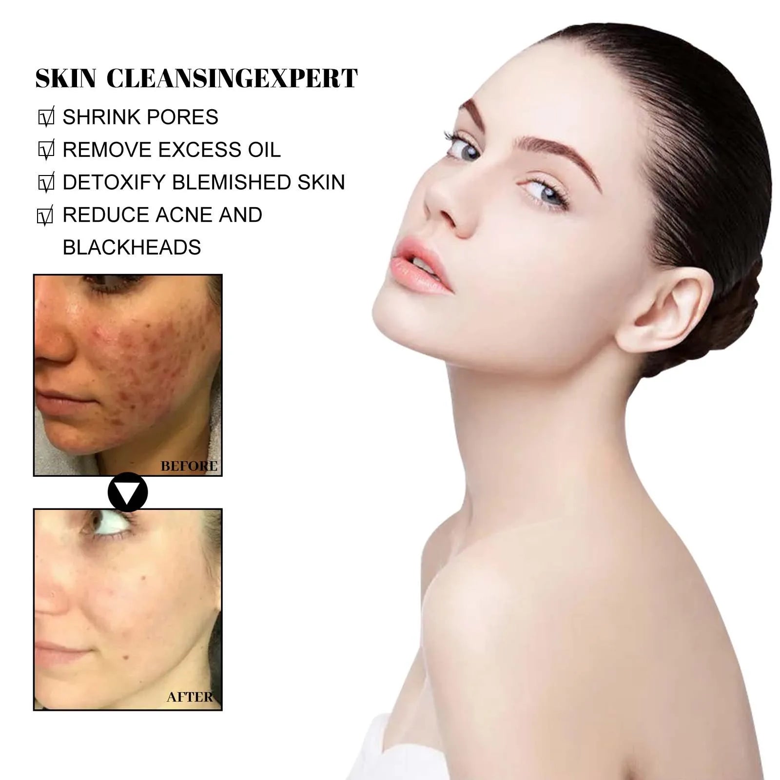 40g 4 pcs Blackhead Cleansing Mud Film, Dilute Acne and Acne Marks, Tighten Pores, Deeply Clean and Moisturize The Skin Oasis Select