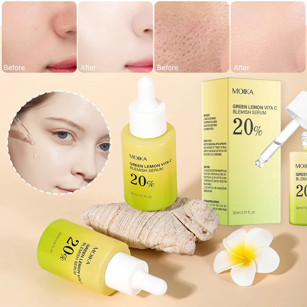 30ml Vitamin C Anti-Oxidation Facial Essence, Reduce Dullness & Even Skin Tone Nourish Skin Care Face Serum Oasis Select