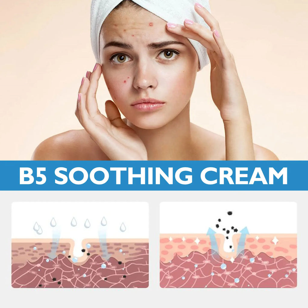 Eelhoe B5 Repair Face Cream – Hydrating Barrier Support Face Repair Cream Oasis Select