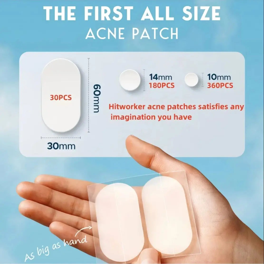 Hydrogel acne removing patch (2 shapes), 190/380 pieces/box, deep cleaning acne removing patch, effective acne removing patch Oasis Select