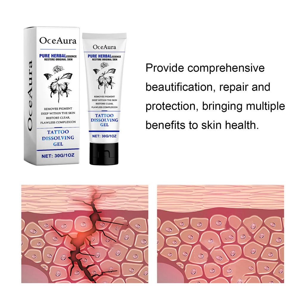 OceAura Tattoo Removal Gel – Painless Fading & Skin Repair Tattoo Removal Gel Oasis Select
