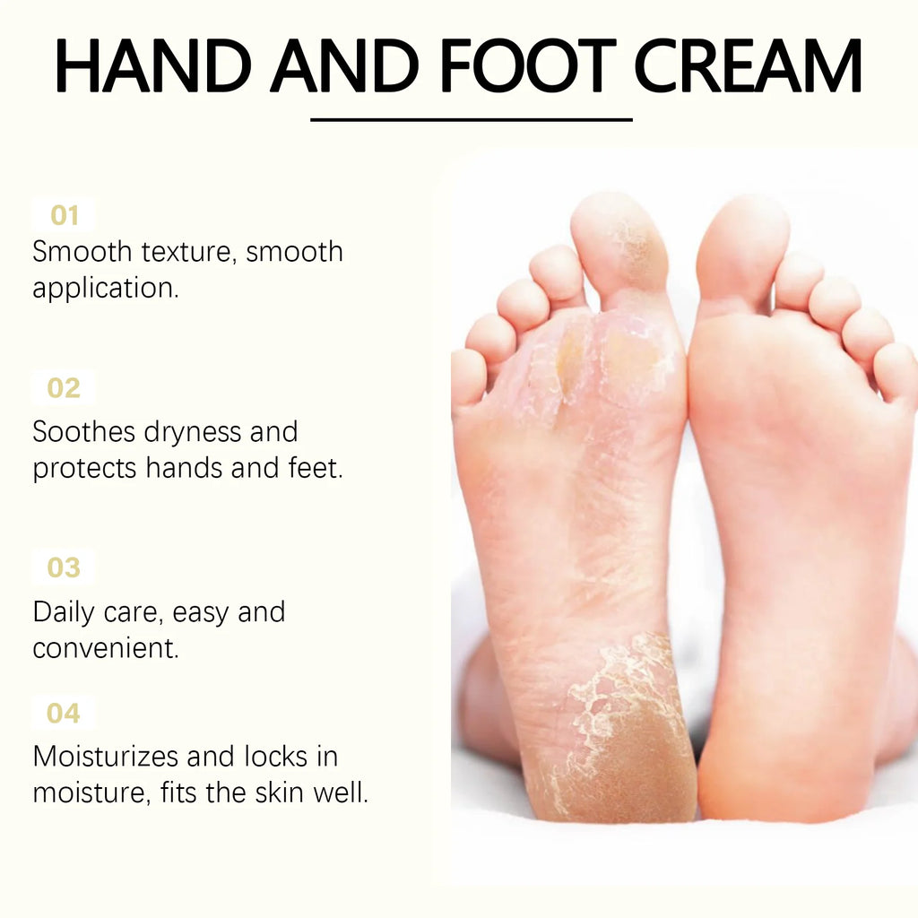 Lanolin Hand Foot Stick For Dry Cracked Rough Skin Gentle Moisturizing Nourishing Anti Crack Preventing Your Feet From Cracking Oasis Select