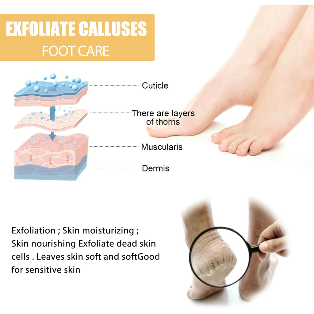 Foot Callus Remover Spray Quickly Soften Calluses Exfoliation Dry Feet Skin Hydrating clean Dead repair Skin cuticles Foot Care Oasis Select
