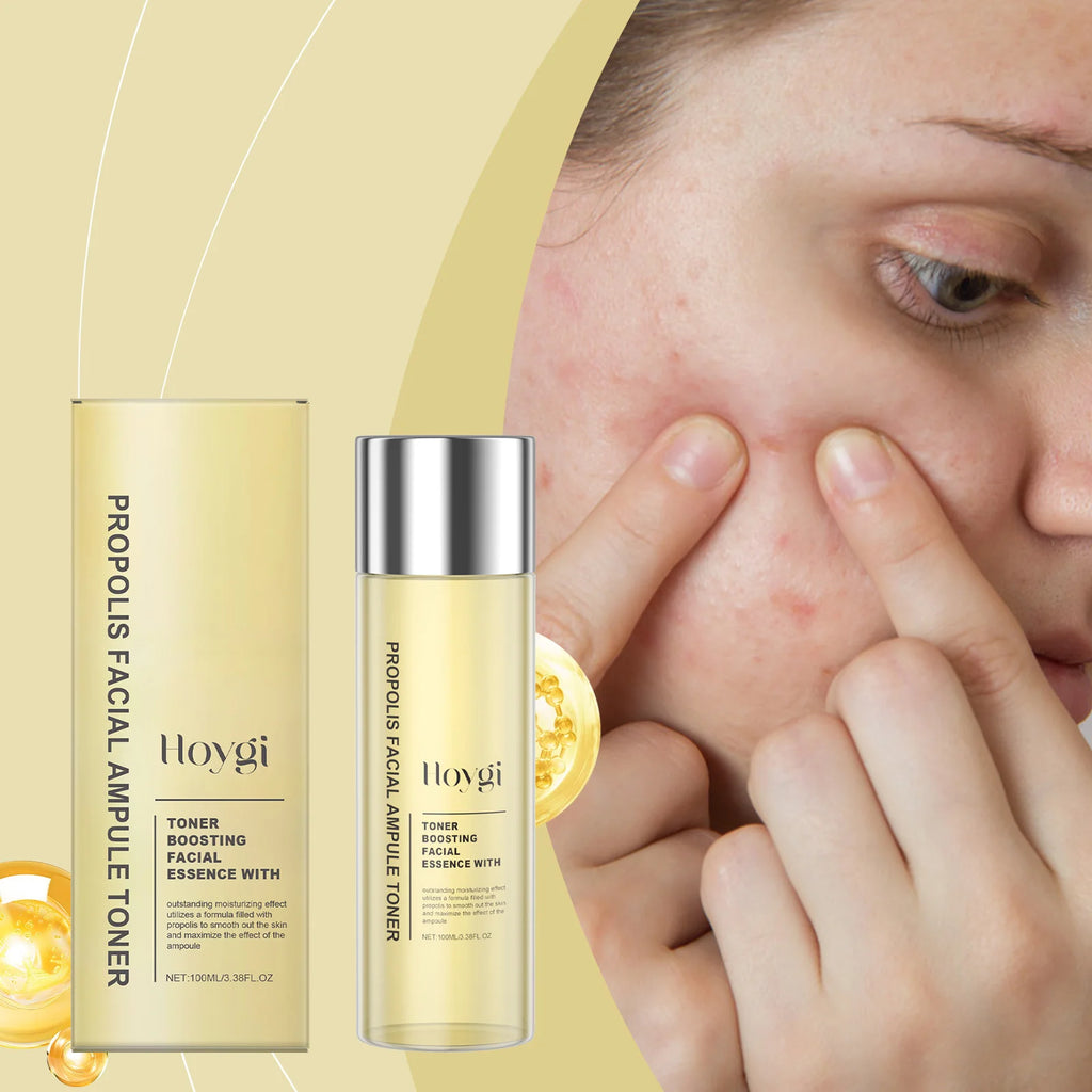 Hoygi Honey Ceramide Facial Toner Moisturizing & Soothing Toner Improve Skin Barrier Nourishing Essence for Sensitive Skin Care Oasis Select