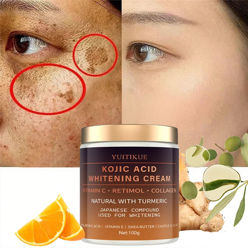 Kojic Acid Whitening Cream – Vitamin C, Turmeric & Hyaluronic Acid