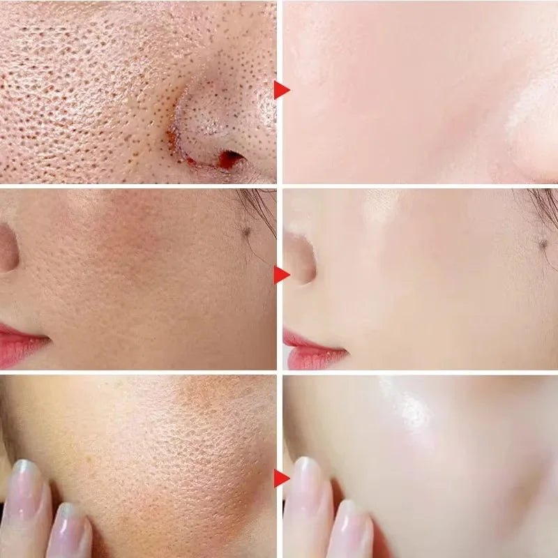 SADOER Calming Face Serum – Sensitive Skin & Pore Minimizer Face Serum Oasis Select