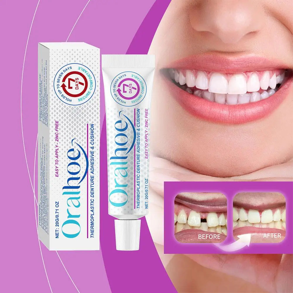 Thermoplastic Denture Adhesive – Secure Fit for Dentures, 20g Denture Adhesive Oasis Select