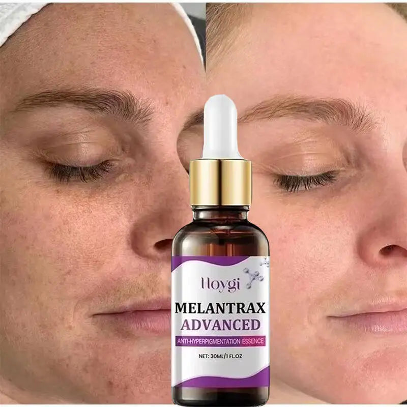 Hoygi Niacinamide Facial Serum Vitamin B3 Wrinkles Pigment Dark Spot Removal Correcting Glow Serum Face Whitening Moisturizer Oasis Select