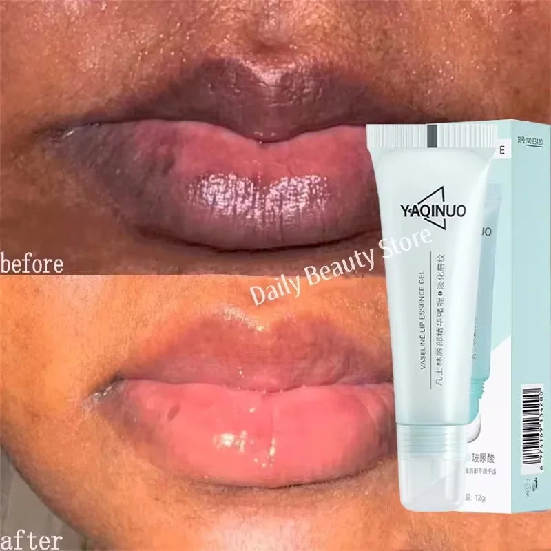 Remove Dark Lip Balm Fast Lightening Pink Lip Exfoliating Fade Lip Line Dead Skin Moisturizer Korean Care Products Beauty Health Oasis Select 1pc