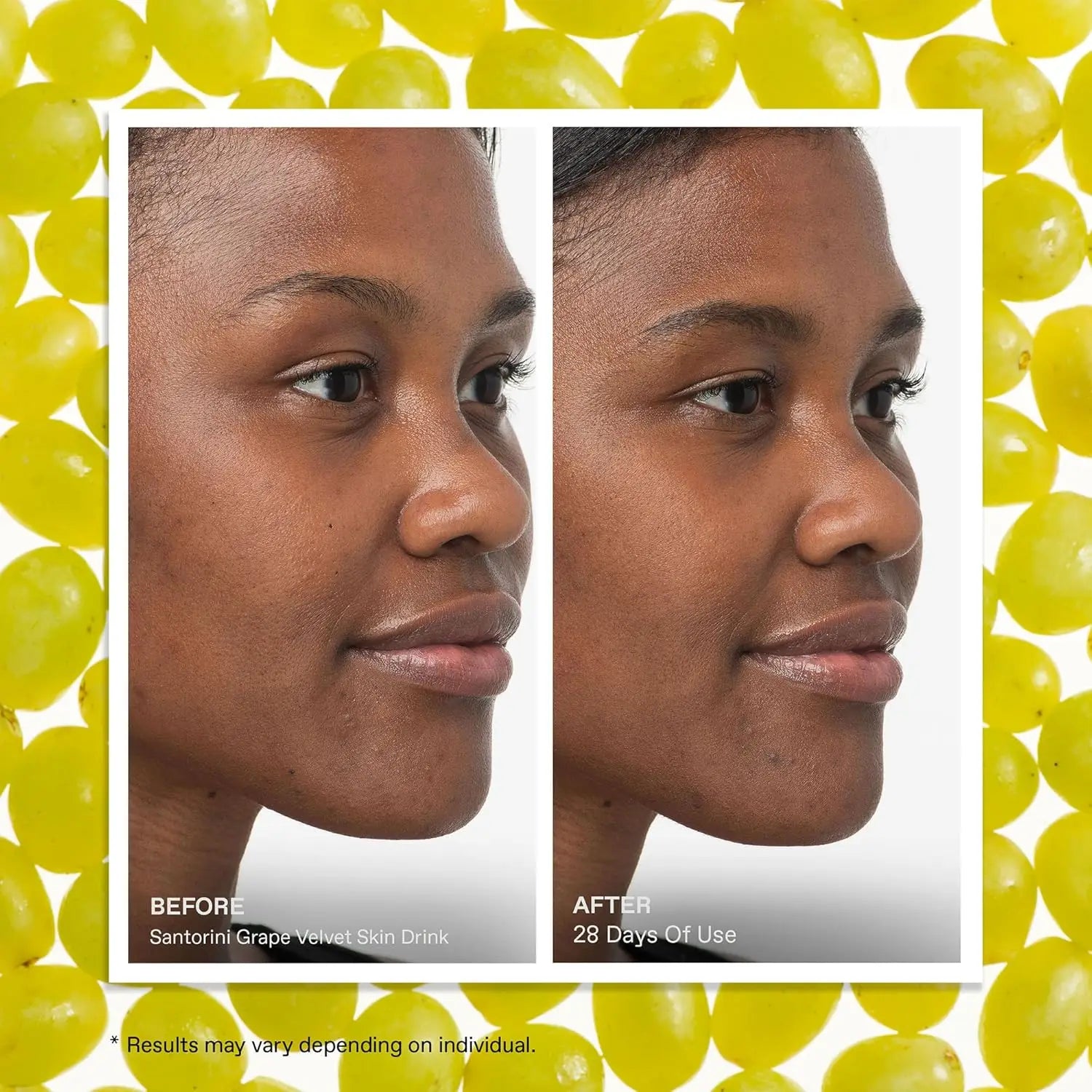 Vitamin C Squalane Face Serum – Brightening & Firming Oil
