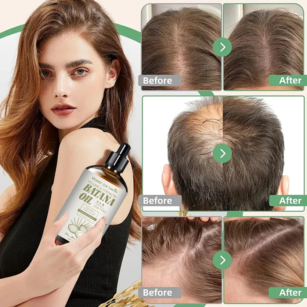 Batana Oil Hair Treatment – Volumizing, Strengthening & Moisturizing Hair Oil Treatment Oasis Select