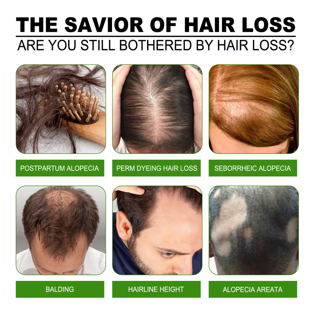 Fast Hair Growth Spray Anti-Baldness Thickening Growing Moisturize Smooth Hair Repair Split Frizz Ginger Scalp Treatment Essence Oasis Select