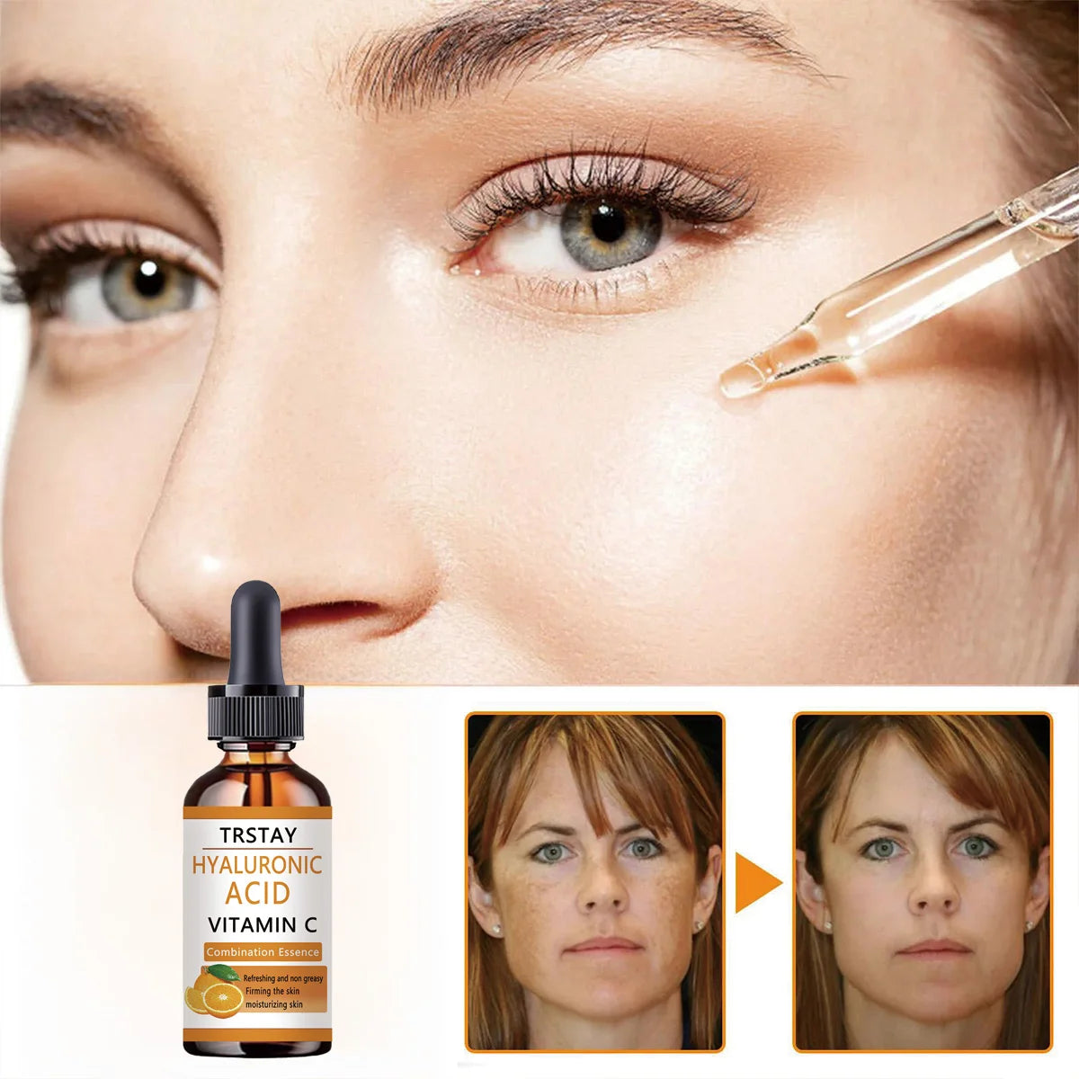 TRSTAY Hyaluronic Acid Brightening Serum - Deeply Hydrates and Nourishes Skin for a Radiant Glow Oasis Select