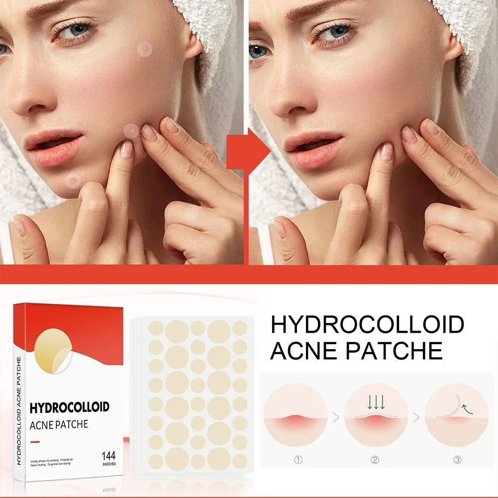 Hydrocolloid Acne Patch Facial Blemishes Pimple Marks Closed Acne Blemishes Cover Acne Pimple Repair Patch Invisible Acne Patch Oasis Select