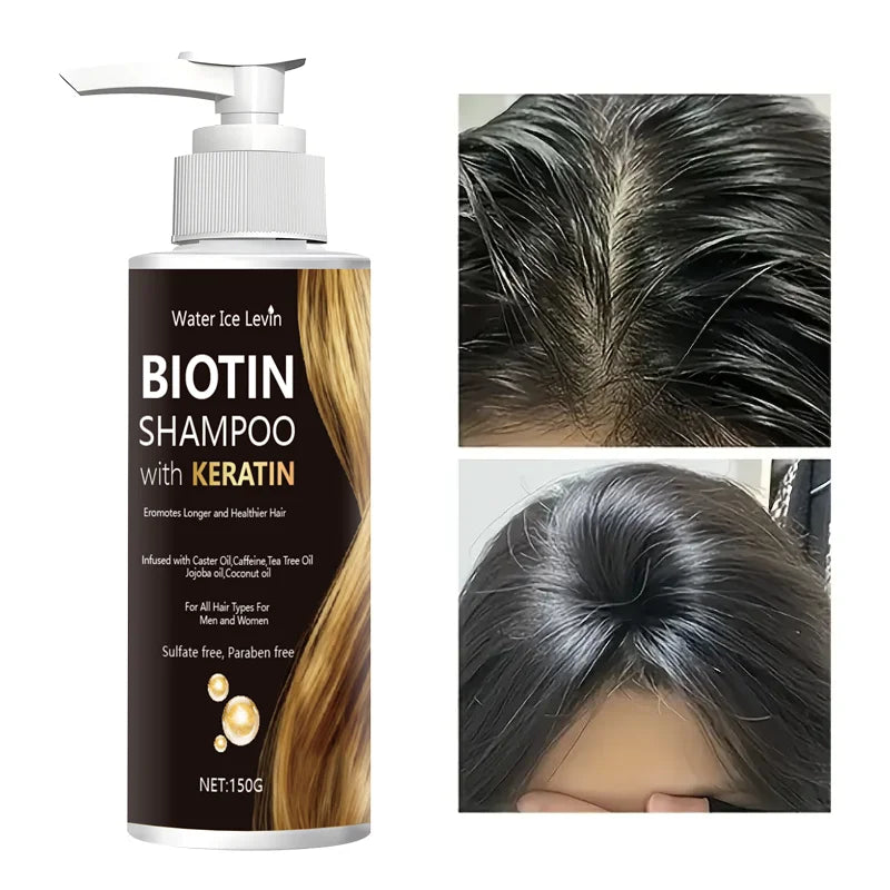 Biotin Keratin Shampoo – Jojoba & Coconut Oil, All Hair Types Biotin Keratin Shampoo Oasis Select