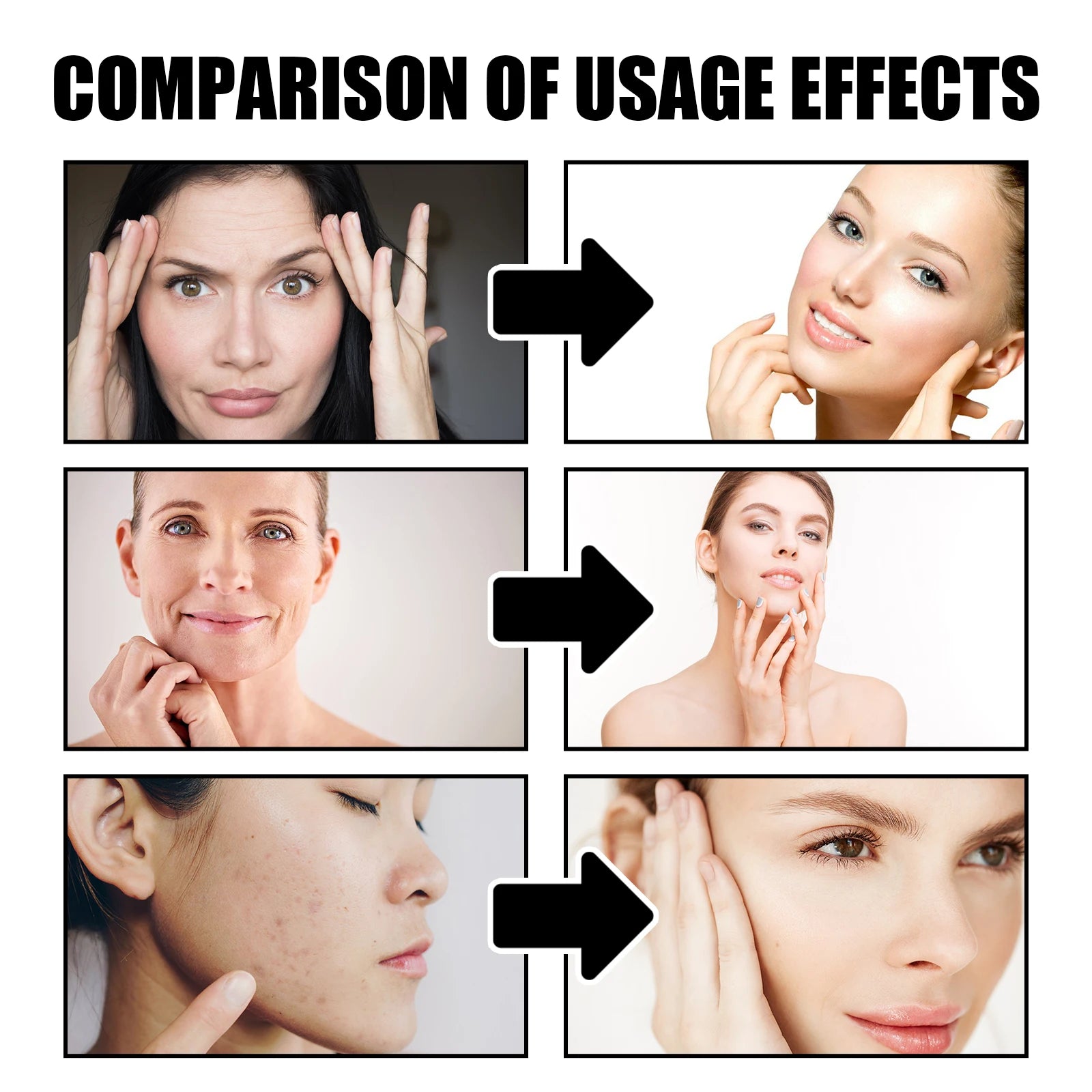 EELHOE Dragon Blood Face Cream – Anti-Aging & Brightening 30g Anti-Aging Face Cream Oasis Select
