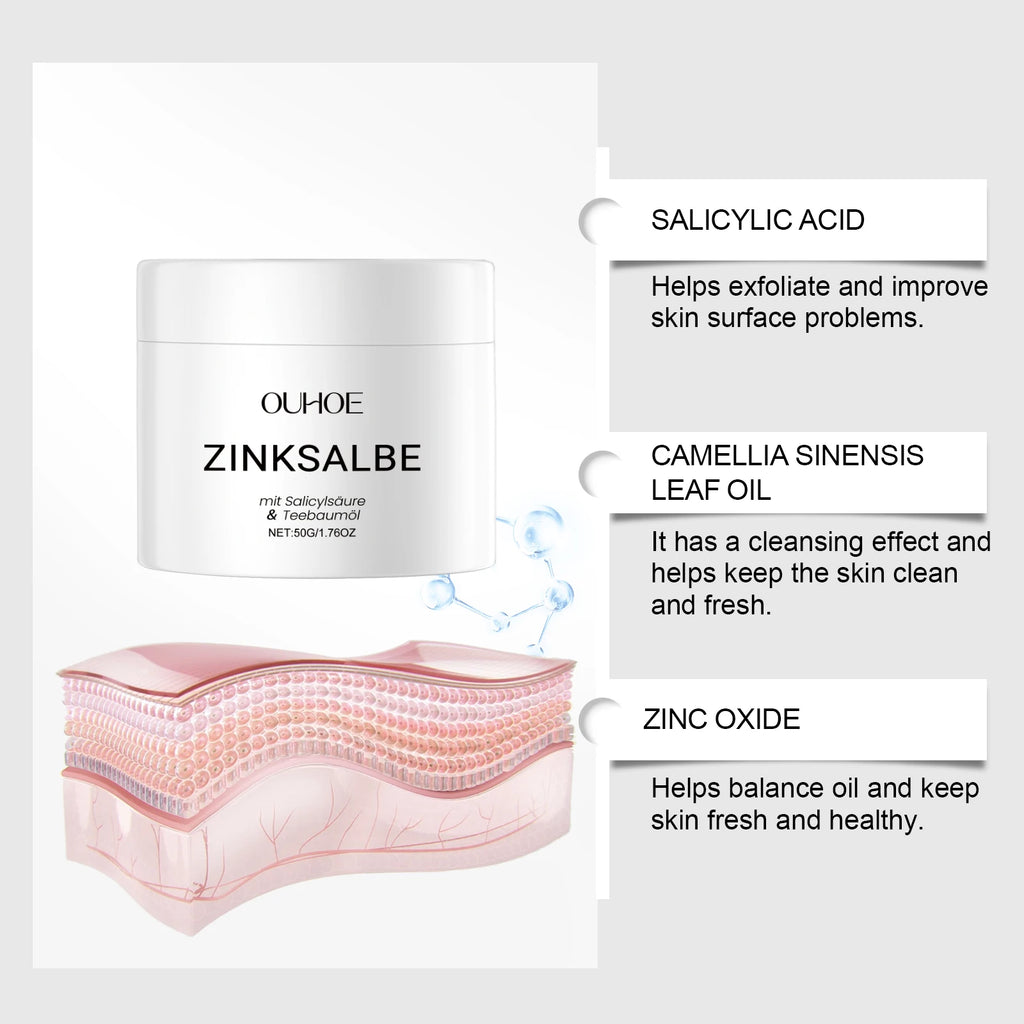 OUHOE Zinc Acne Cream – Pimple Marks, Pores & Oil Control 50g Acne Treatment Cream Oasis Select