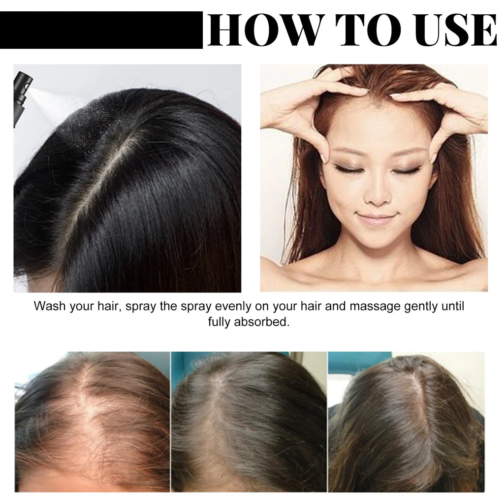 Batana Oil Hair Growth Spray – Anti Hair Loss Treatment 30ml Hair Growth Spray Oasis Select