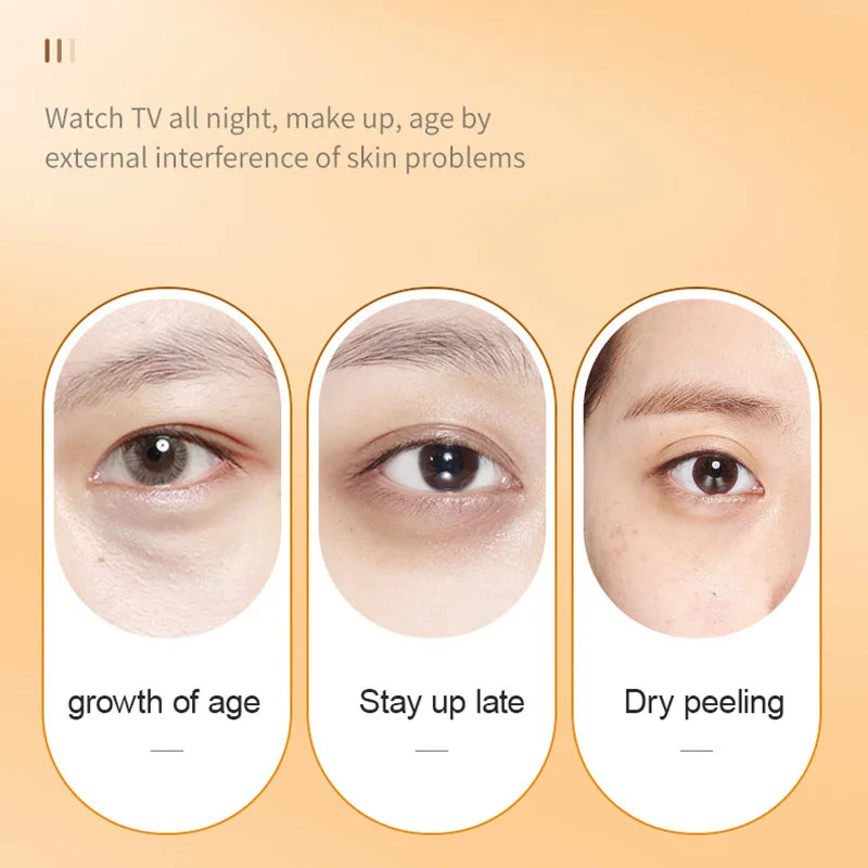 SADOER Vitamin C Eye Cream – Dark Circles & Puffiness 20g Eye Cream Oasis Select
